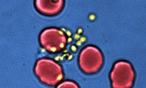 parasites (yellow) infect neighboring cells (red). Photograph: A. Crick and P. Cicuta